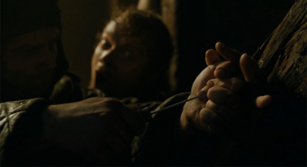 Torturando a Theon