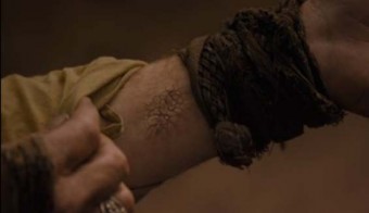 Jorah Psoriagrís HBO